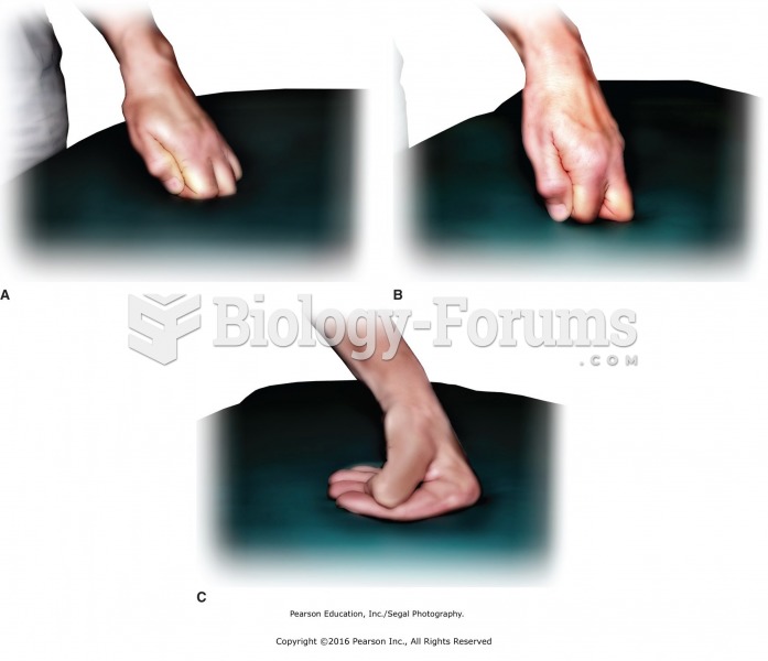 Different hand positions and working surfaces for massage applications on large muscles. A. Flat ...