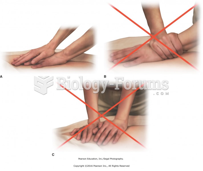 Correct wrist position while performing compression. A. Correct wrist position for compression ...