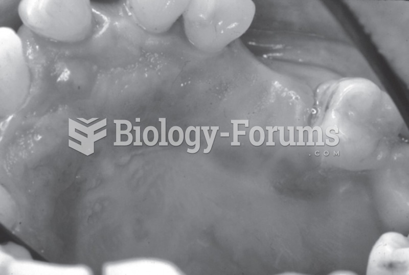 Denture sore mouth in a patient who never removed partial dentures at night. 