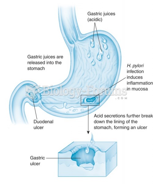 Mechanism of peptic ulcer formation.