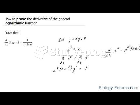 How to prove the derivative of the general logarithmic function 