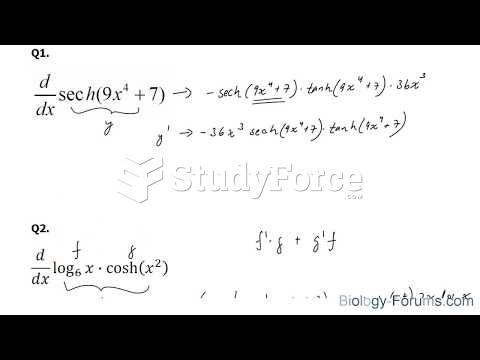 How to find the derivatives of hyperbolic functions