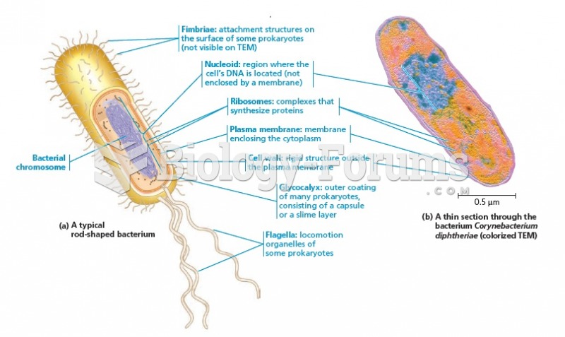 A prokaryotic cell.