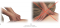 Stacking the joints. A. Correct thumb–wrist alignment for applying direct pressure. B. Incorrect ...