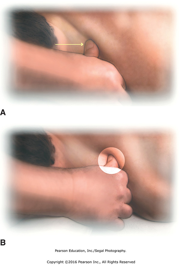 A) Thumb press across top of shoulder. (B) Repeated pressing to GB-21 to disperse energy; massage ...