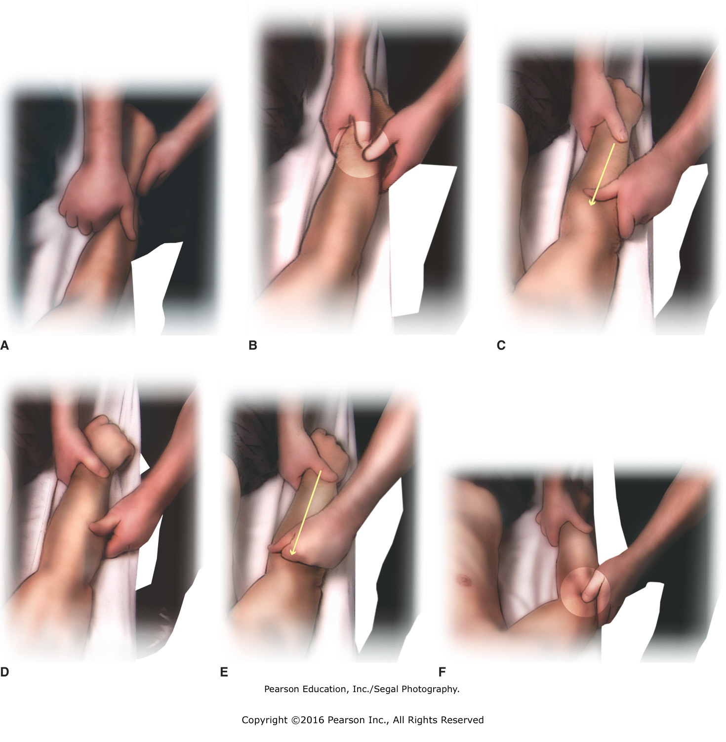 Apply kneading and deep stroking to lower arm muscles. (A) Knead muscle bellies. (B) Thumb press ...