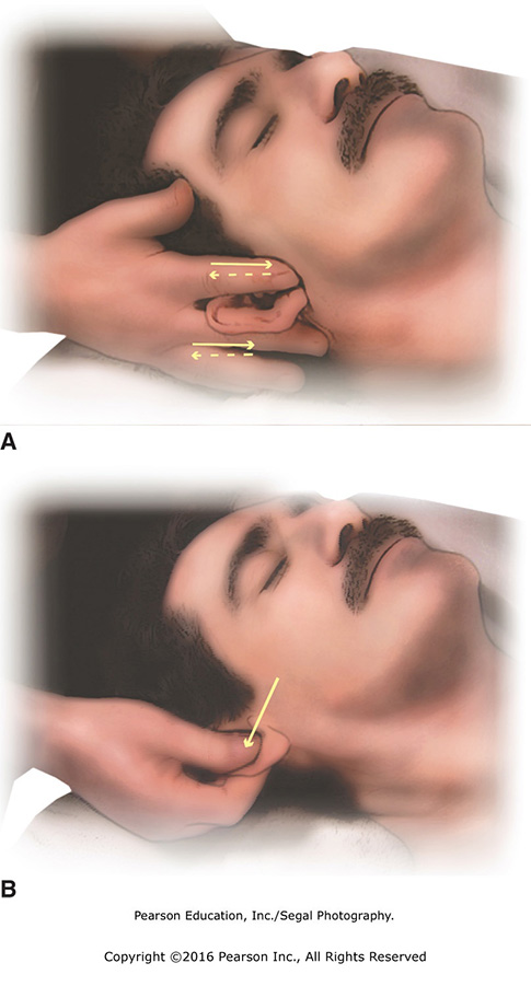 (A) Massage the ears between thumb and fingers. (B) Gently pull on ears.