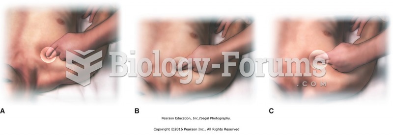 Finger press acupoints under the clavicle: (A) Ki-27, (B) Lu-2, (C) Lu-1.