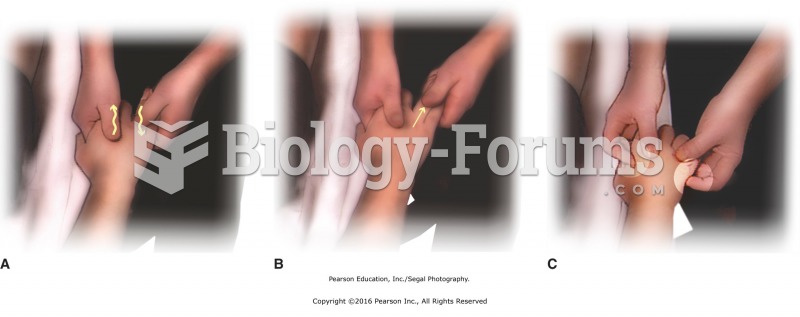 General hand massage. Include (A) metacarpal mobilizations and (B) gentle finger pulls. (C) Press ...
