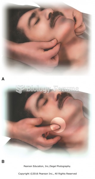 (A) Pinch along jaw line from midline to lateral aspect. (B) Press St-6 at masseter attachment.