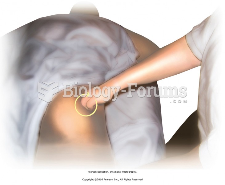 Circular friction to gluteal muscle attachments using the fist. Use the knuckles or the middle ...