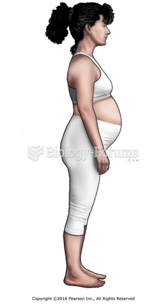Typical pregnancy posture.