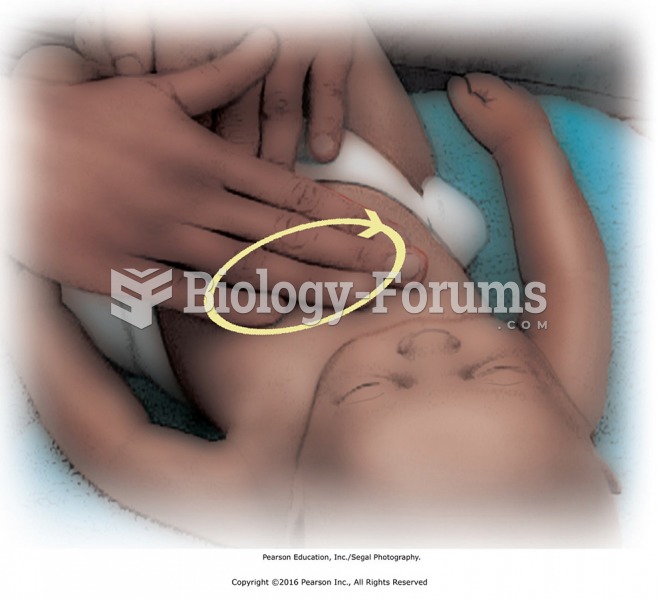 Using oil or lotion, apply circular strokes on abdomen with fingertips. Move in a clockwise ...