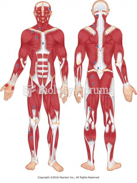 Common trigger point locations, anterior and posterior.