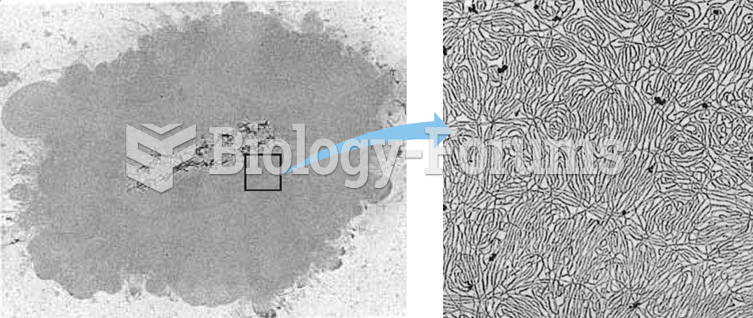 The DNA from one chromosome has a mass of ~20 billion Daltons