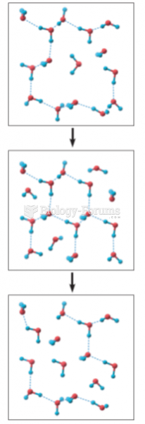 The structure of liquid water