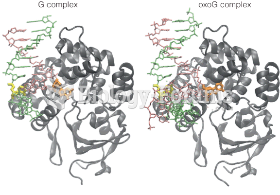 Structure of human OGG1 with either guanine or 8-oxoguanine bound flipped out and bound