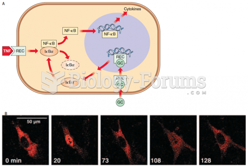 Action of glucocorticoids (GCs) in suppressing immune and inflammatory reactions mediated by cytokin