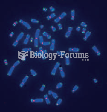 Mitotic human chromosomes in metaphase