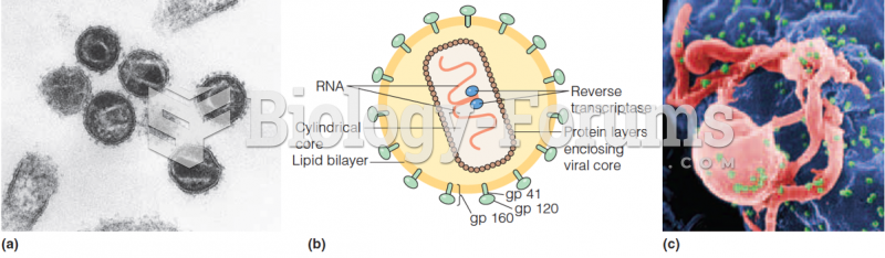 Human immunodeficiency virus (HIV) micrograph