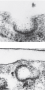 Receptor-mediated endocytosis of LDL