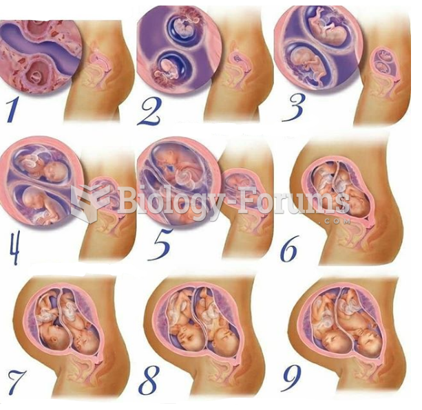 Gestational evolution: Twin Development