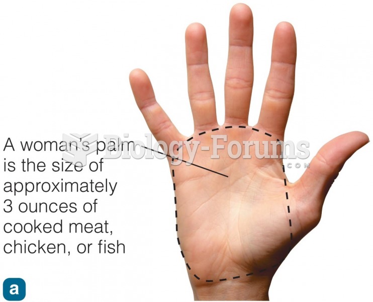 A Women's palm