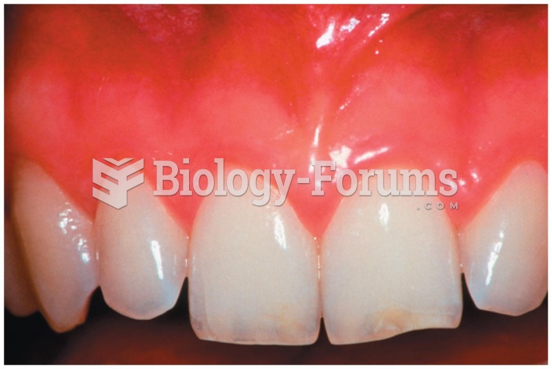 Gingivitis causes redness and swelling of the gums and can lead to more serious gum disease