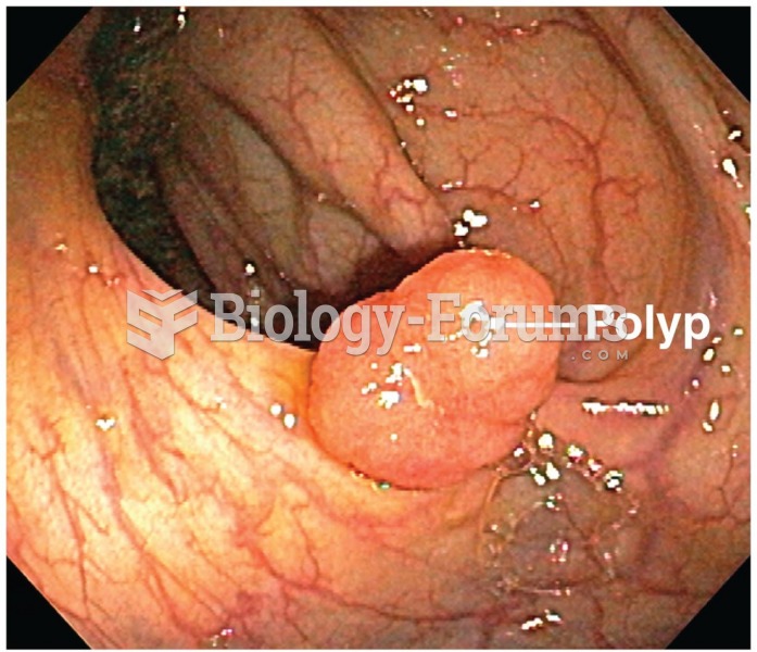 Polyps, or abnormal growths, on the lining of the large intestine may indicate early stages of colon