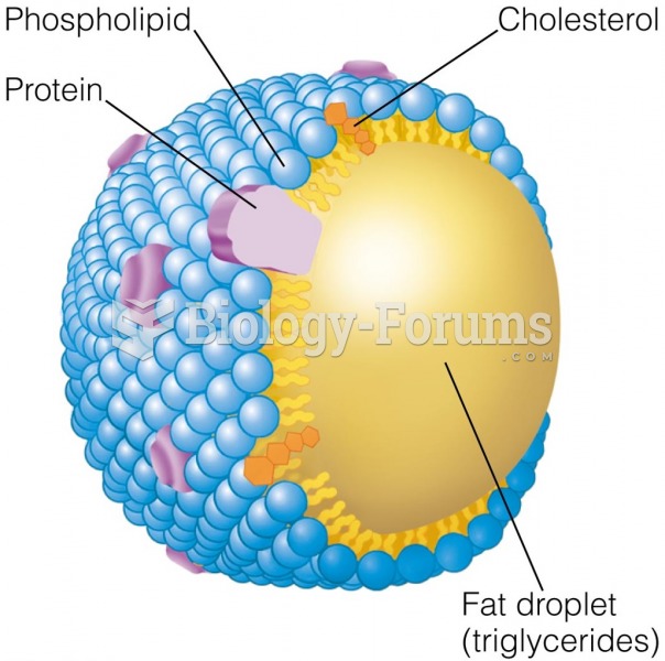 Chylomicron Chylomicrons are one type of lipoprotein