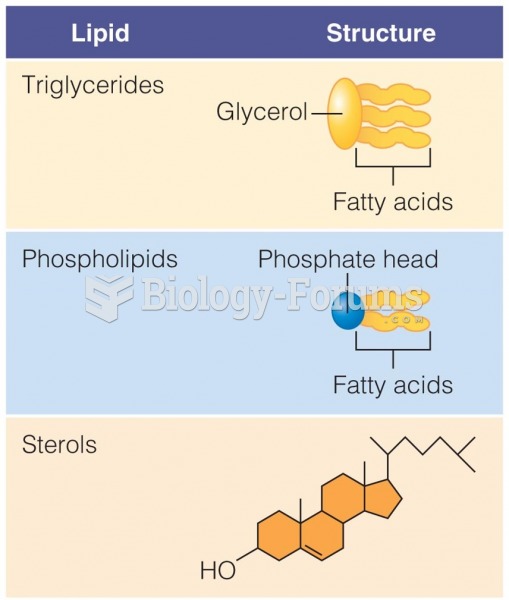 Three classifications of lipids