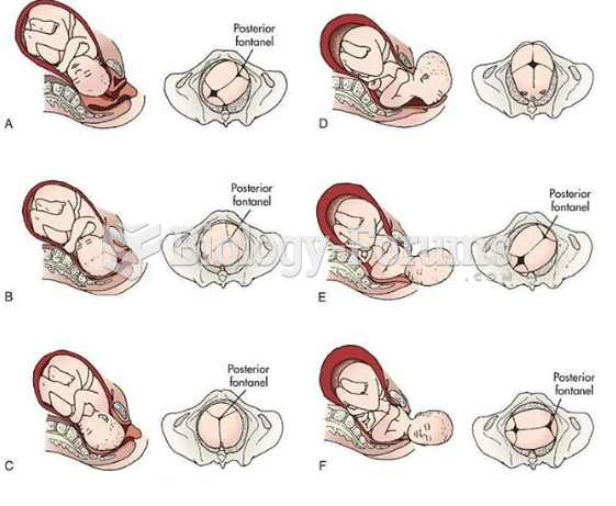 Stages of Natural Birth "مراحل الولادة الطبيعية"