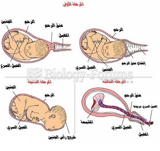 Stages of Natural Fetal Birth "مراحل الولادة الطبيعية"