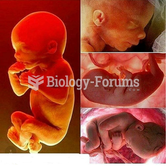 Human embryo fetus Growth