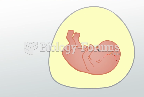 What is Amniotic Fluid?