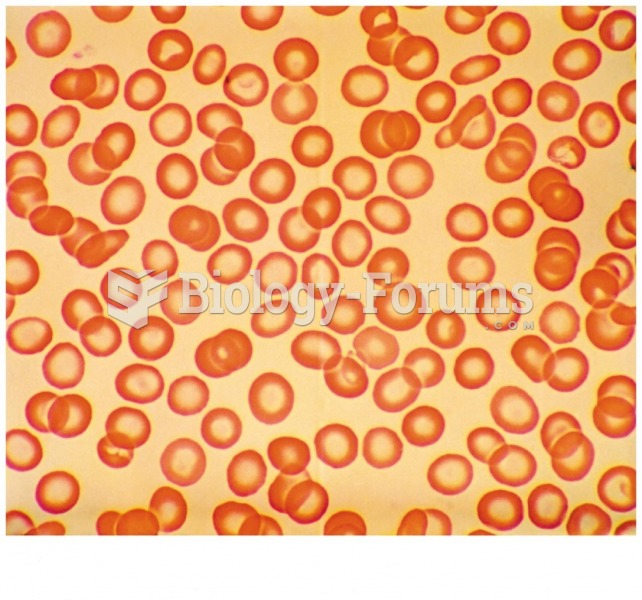 Anemic Red Blood Cells