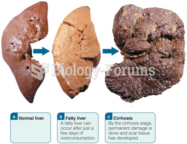 Alcoholic Liver Disease