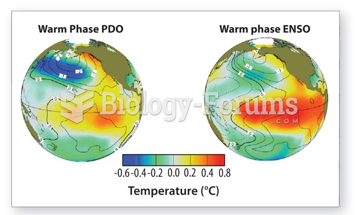 Pacific Decadal Oscillation: Temperature in degree Celsius