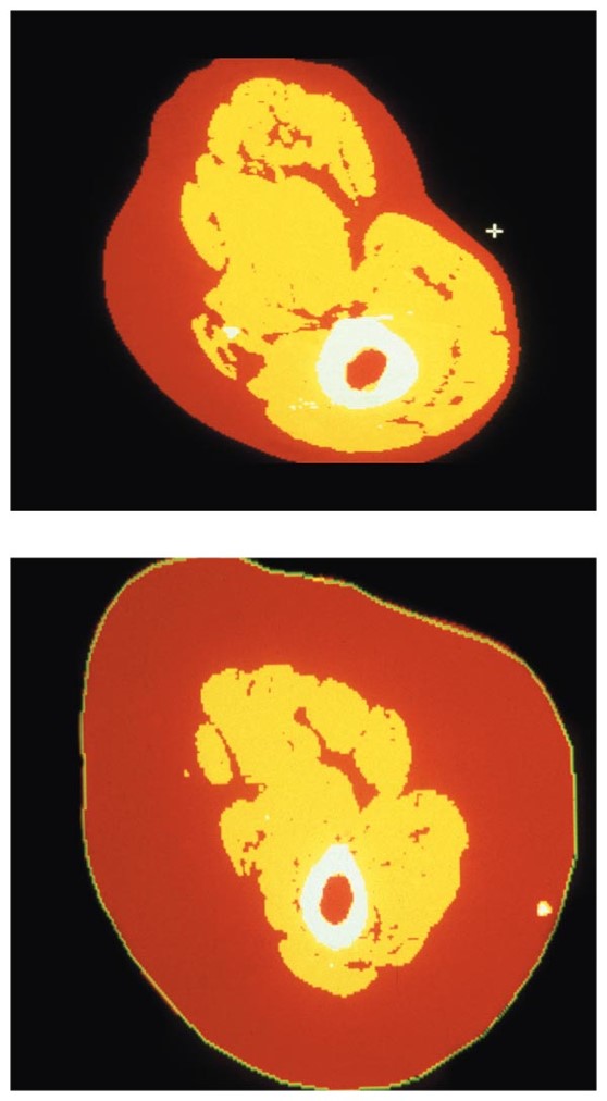 Cross sections of the thigh