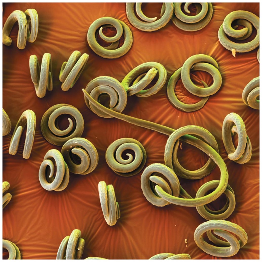 The parasitic roundworm Trichinella spiralis