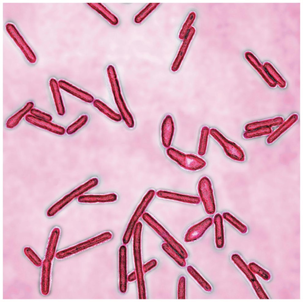 Clostridium botulinum