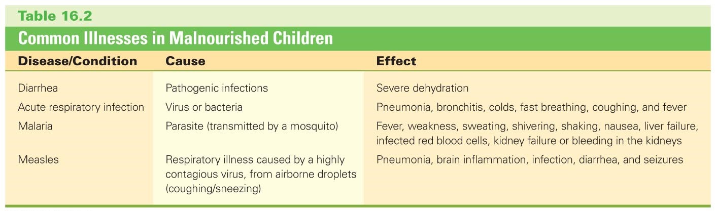 Common Illnesses in Malnourished Children