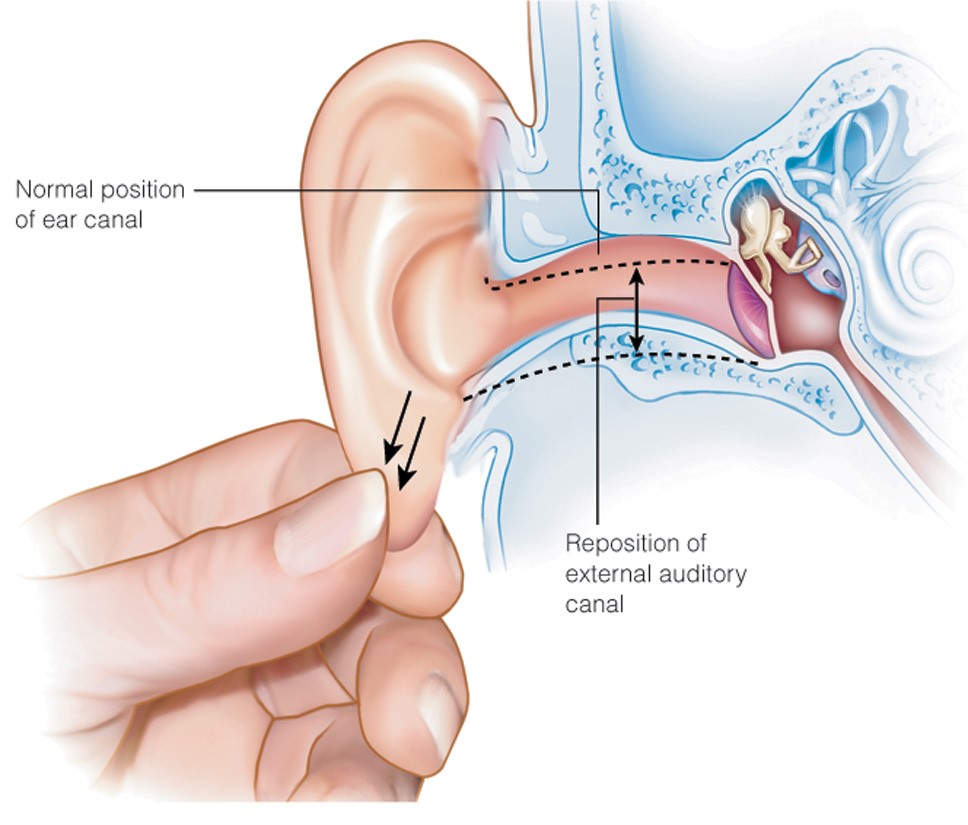 Positioning of external auditory canal for tympanic membrane visualization