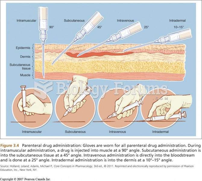 Parenteral Administration