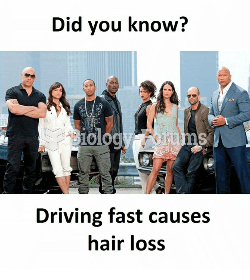 DID YOU KNOW? DRIVING FAST CAUSES HAIR LOSS