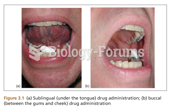 Sublingual and Buccal
