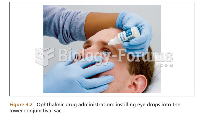 Ophthalmic drug administration