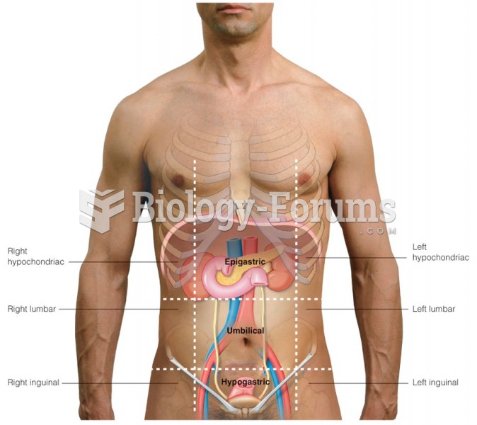 Mapping of the abdomen into nine regions