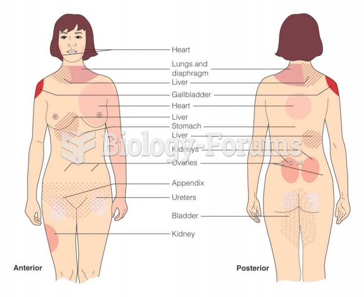 Sites of referred pain