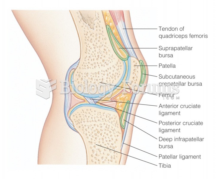 Knee joint: Sagittal section through the right knee